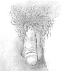 Drawing of a natural penis
